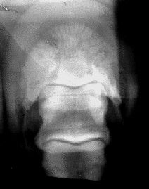 Sound and healthy wild horse hoof in absence of WHID (Whole Horse Inflammatory Disease) that is the underlying condition of Laminitis, pathological separation of the hoof from the horse. When inflammation reaches catastrophic levels hoof can literally fall off the horse, so called "hoof slough". Photo showing healthy lamellar attachment.